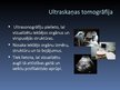 Prezentācija 'Tomogrāfija medicīnā', 6.
