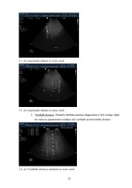 Diplomdarbs 'Ultraskaņas iekārtas novecošanas ietekme uz attēla kvalitāti', 22.