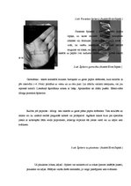 Referāts 'Špikošana', 8.
