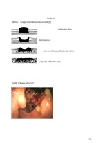 Referāts 'Kuņģa vēzis', 12.