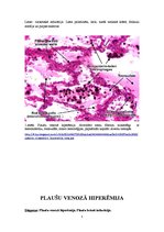 Konspekts 'Plaušu venozā pilnasinība (plaušu brūnā indurācija)', 5.