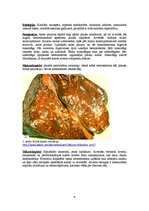 Konspekts 'Plaušu venozā pilnasinība (plaušu brūnā indurācija)', 6.