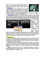 Konspekts 'Hroniskas nieru mazspējas ietekme uz cilvēka pamatvajadzībām', 7.