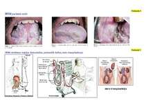 Konspekts 'Hroniskas nieru mazspējas ietekme uz cilvēka pamatvajadzībām', 20.