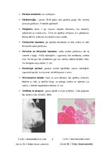 Konspekts 'Odontogēnas un neodontogēnas žokļu cistas', 5.