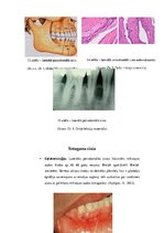 Konspekts 'Odontogēnas un neodontogēnas žokļu cistas', 12.