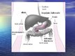 Prezentācija 'Hronisks pankreatīts', 11.