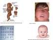 Prezentācija 'Ģenētikas pētīšanas metodes - amniocentēze', 11.