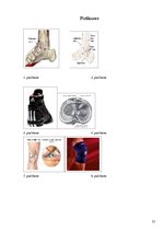 Referāts 'Izplatītākās basketbola traumas un izvairīšanās no tām', 21.