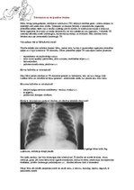 Konspekts 'Tuberkuloze bērniem', 2.