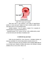 Referāts 'Galvas sāpes, to cēloņi un diagnostika', 9.
