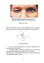 Referāts 'Galvas sāpes, to cēloņi un diagnostika', 10.