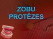 Prezentācija 'Zobu protezēšana', 1.
