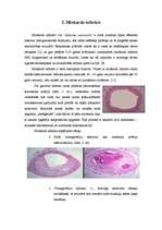 Referāts 'Miokarda infarkts', 5.