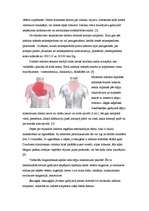 Referāts 'Miokarda infarkts', 7.