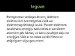 Prezentācija 'Rentgenstarojums', 4.
