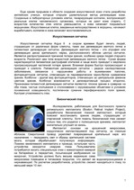 Referāts 'Искусственные органы человеческого тела и современные протезы', 7.