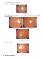 Konspekts 'Glaukoma', 6.