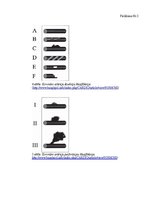 Referāts 'Biežākās komplikācijas, veicot perkutāno koronāro intervenci pacientiem ar', 45.