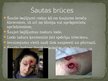 Prezentācija 'Mehāniski atvērtās traumas', 5.