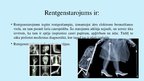 Prezentācija 'Rentgenstarojums', 2.