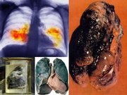 Prezentācija 'Курение и молодёжь', 18.