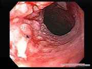 Prezentācija 'Курение и молодёжь', 22.