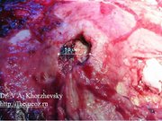 Prezentācija 'Курение и молодёжь', 24.