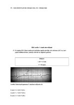 Paraugs 'Elektrokardiogrāfija', 3.