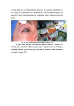 Referāts 'Lāzerskalpeļi medicīnā', 15.