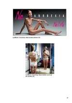 Referāts 'Sabiedrībā pastāvošo stereotipu izraisītie ēšanas traucējumi', 47.