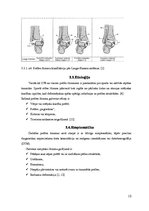 Referāts 'Apakšstilba un potītes biežākie lūzumi. Pirmā palīdzība apakšstilba lūzuma gadīj', 10.