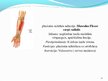 Prezentācija 'Cilvēka augšējo ekstremitāšu muskuļi', 14.