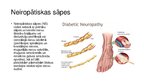 Prezentācija 'Pacientu aprūpe ar neiropātiskām sāpēm', 4.