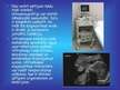 Prezentācija 'Medicīnas tehnoloģijas: rentgens, ultrasonogrāfija', 7.