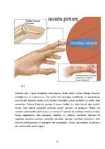Referāts 'Profesionālā sporta ietekme uz cilvēka veselību', 23.