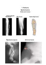 Referāts 'Profesionālā sporta ietekme uz cilvēka veselību', 38.