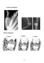 Referāts 'Profesionālā sporta ietekme uz cilvēka veselību', 39.