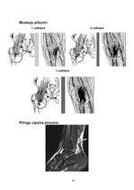 Referāts 'Profesionālā sporta ietekme uz cilvēka veselību', 40.