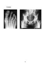 Referāts 'Profesionālā sporta ietekme uz cilvēka veselību', 42.