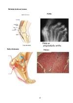 Referāts 'Profesionālā sporta ietekme uz cilvēka veselību', 43.