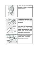 Konspekts 'Cukura diabēts', 6.