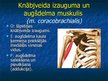 Prezentācija 'Ekstremitāšu muskuļi', 13.