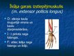 Prezentācija 'Ekstremitāšu muskuļi', 33.