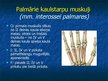 Prezentācija 'Ekstremitāšu muskuļi', 42.