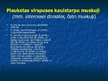 Prezentācija 'Ekstremitāšu muskuļi', 43.