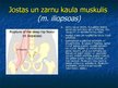 Prezentācija 'Ekstremitāšu muskuļi', 50.