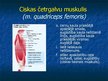 Prezentācija 'Ekstremitāšu muskuļi', 60.