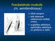 Prezentācija 'Ekstremitāšu muskuļi', 68.