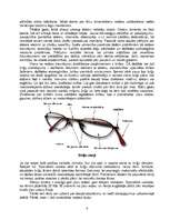 Referāts 'Redze un brilles', 6.